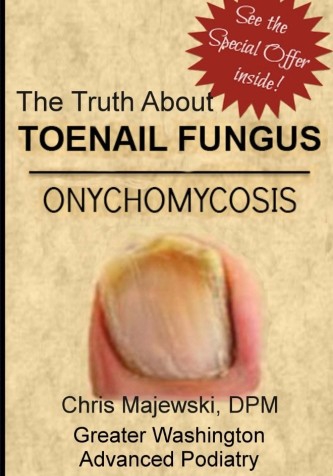 The Truth About Toenail Fungus by Dr. Christopher Majewski
