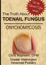 The Truth About Toenail Fungus - Download the First Chapter For Free